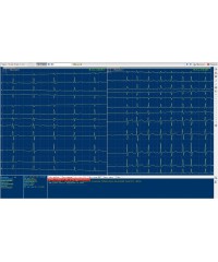 «Домашний кардиоанализатор» (электрокардиограф)