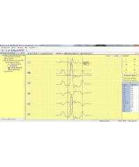 Электрокардиограф Поли-Спектр-8/В для ветеринарии